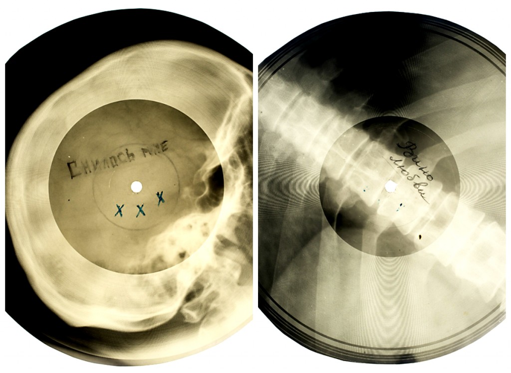 X Ray LPs 2